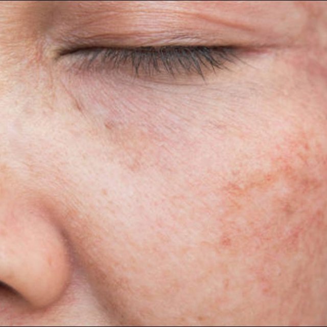 AAA Skin Solutions